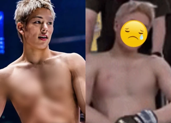 The crazy boxer shook social media because he resembled Hua Quang Han, bruised after the match, making fans sad