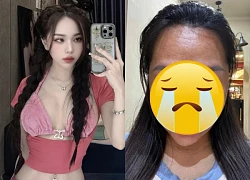 Cô gái cãi lời bác sĩ khi mang thai, đăng ảnh trước và sau khiến CĐM sửng sốt