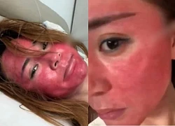 Người phụ nữ tiết lộ lý do "sốc", 22 năm không tẩy trang khuôn mặt "biến dạng"!