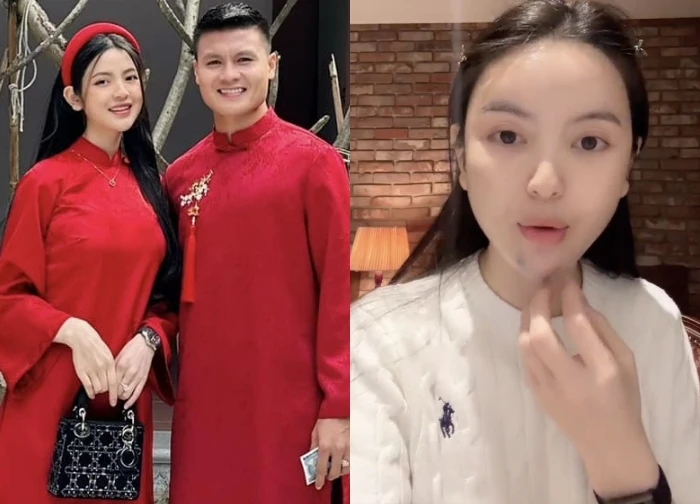 Quang Hai's wife reveals swollen chin, recounts horrifying experience related to "plastic surgery"