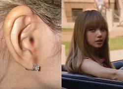 Lisa is injured, bleeding in the ear, Blackpink Concert may only have 3 performers?