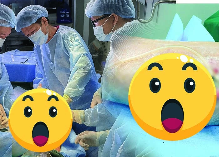 Full-body filler injections: the girl screamed, exposed the muscle bandage, the doctor entered the suffocating operation