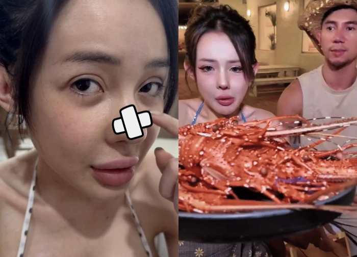 Ngan 98 almost cut off her nose after 11 plastic surgeries, and still calmly ate "toxic" food, netizens booed?