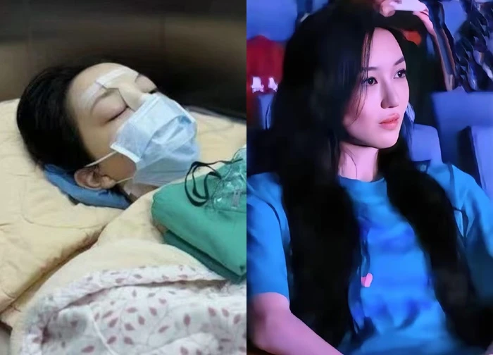 Không nhận ra con gái 19 tuổi của Vương Phi sau 4 lần phẫu thuật hở hàm ếch