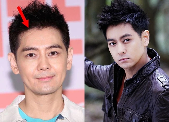 Nam thần đình đám 'Thiên long bát bộ' từng bị tai nạn vỡ xương mặt giờ ra sao?