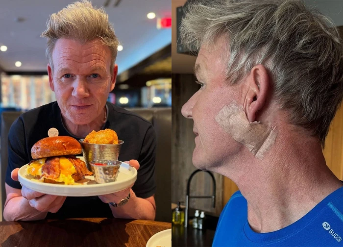 GORDON RAMSAY: "Vua đầu bếp" đối mặt ung thư, lời khuyên cuối cùng "sốc"