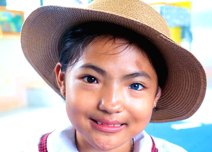 Dak Lak girl causes stir in online community because of rare "two-colored" eyes