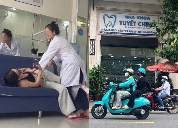 Bác sĩ nha khoa giải thích lý do đánh bệnh nhân chỉnh răng tại phòng khám TPHCM