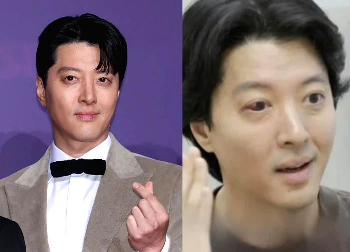 Lee Dong Gun "revealed" he has a rare disease, his health is declining, new images cause a stir