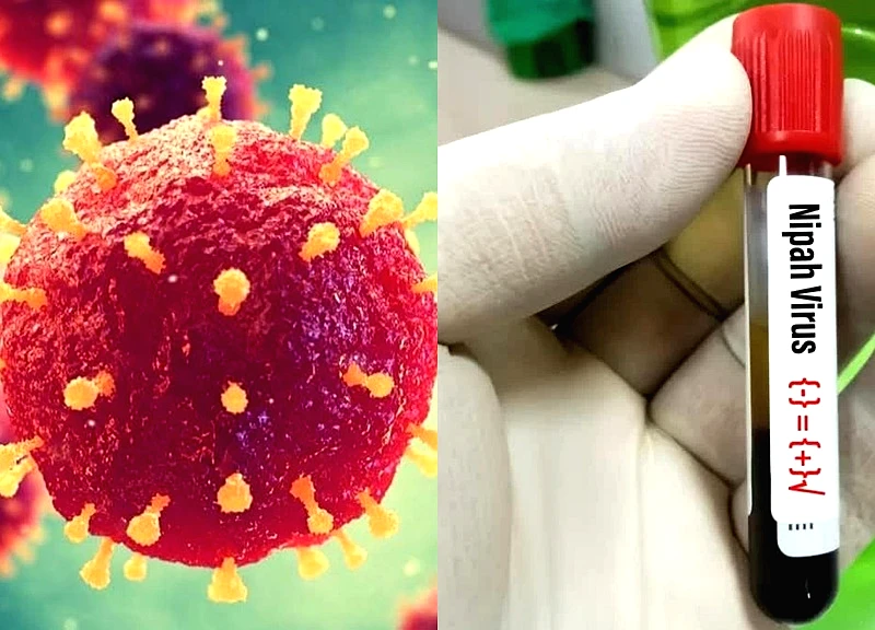 Hy vọng mới ngăn chặn virus Nipah từ loại thuốc điều trị Covid-19