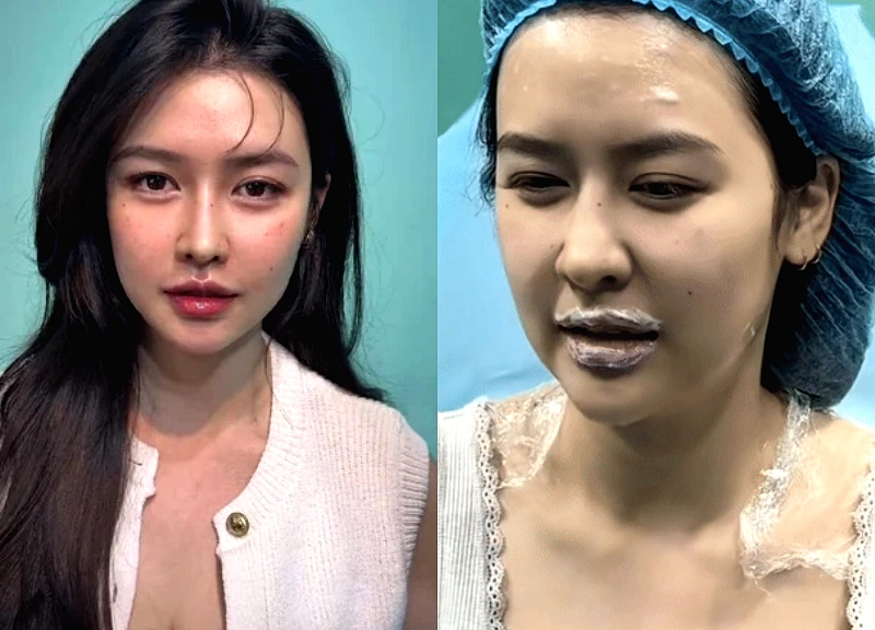 Quyen Qui corrected her face, was supported by her vice president's boyfriend?