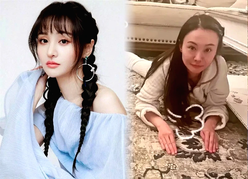 Trịnh Sảng lộ gương mặt biến dạng, nghi thẩm mỹ bị hư, cặp đại gia đòi tái xuất?