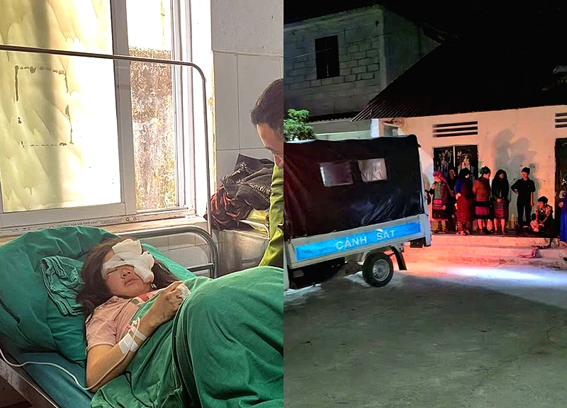 Thai phụ bị đá lăn trúng đầu và bụng