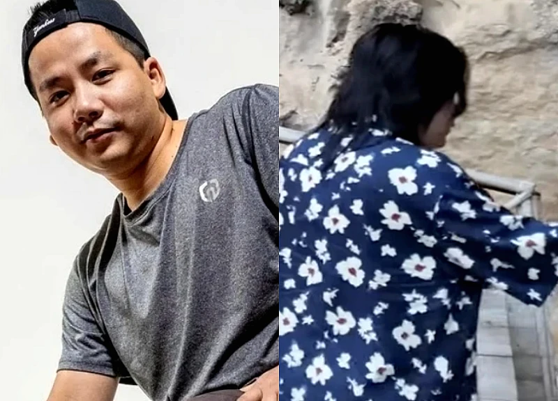 Cú trượt dài của Khoa Pug sau 2 lần mổ kéo chân để cao 1m80