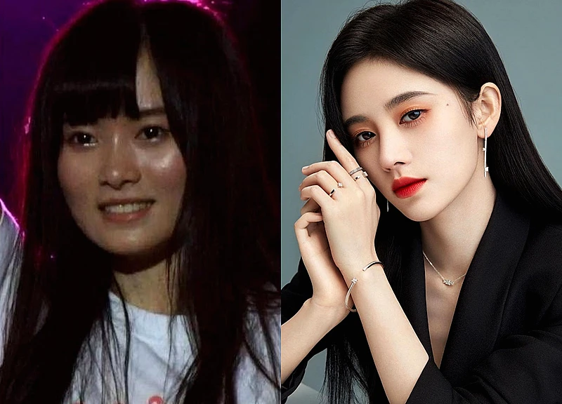 Top 5 mỹ nhân "mặt nhựa" showbiz: Nhìn ảnh quá khứ - hiện tại của trùm cuối mà hết hồn