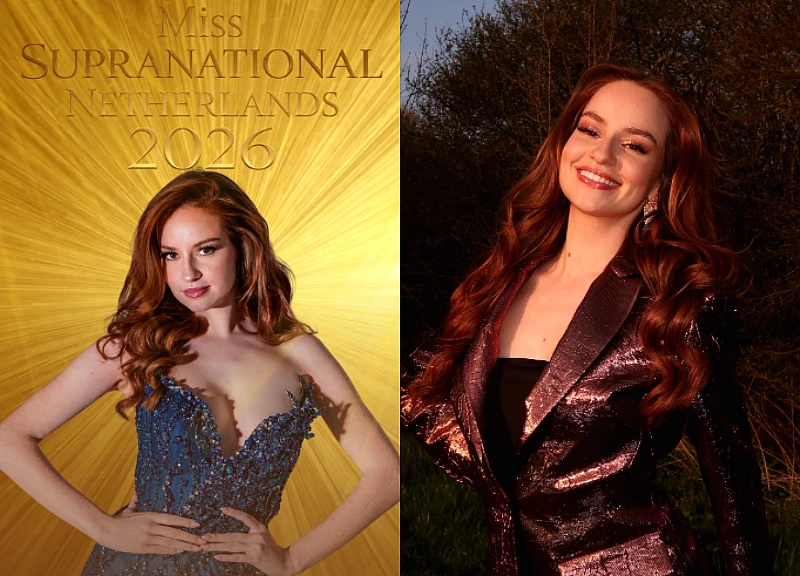 Miss Supranational Netherlands 2026 faces ostracism for unusual hair ...
