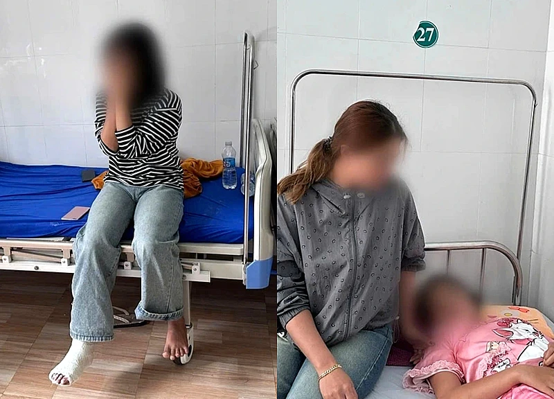Nữ sinh lớp 7 bị bạn đánh gãy xương sườn