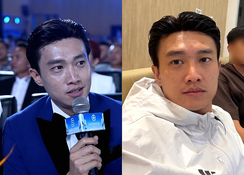 Quốc Trường gặp kiếp nạn khi chấm thi hoa hậu, lộ mặt toàn mụn thâm trên TV