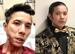 Kasim Hoang Vu died at the age of 46, revealing the last will full of sorrow in the country