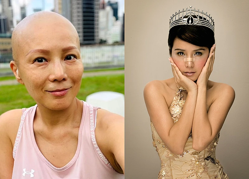 Á hậu bị lừa sạch gia tài, phải bán của hồi môn để chữa bệnh ung thư