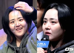 Nhan sắc khác lạ của "em gái quốc dân" Moon Geun Young sau khi mắc bệnh quái ác