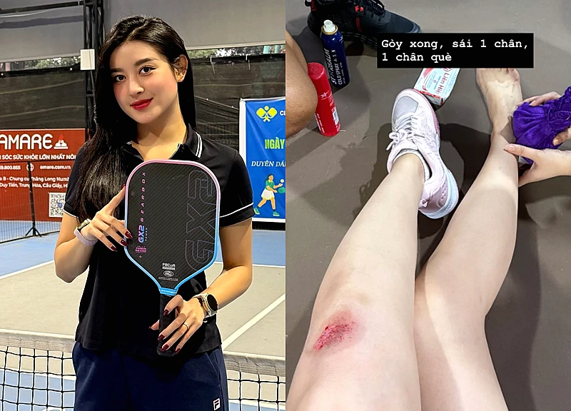 Á hậu Huyền My gặp tai nạn khi chơi pickleball