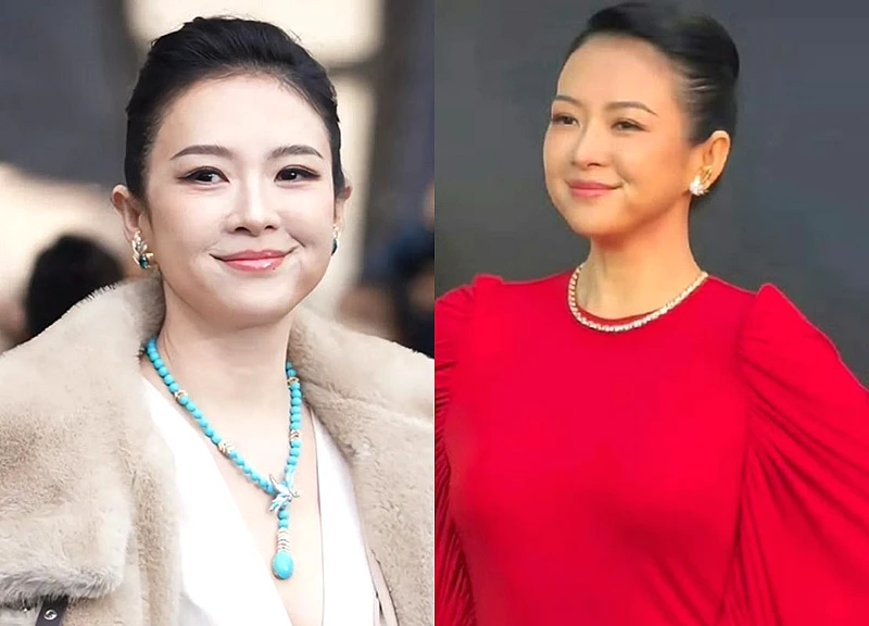 Chương Tử Di lên tiếng về gương mặt sưng, không nếp nhăn gây xôn xao