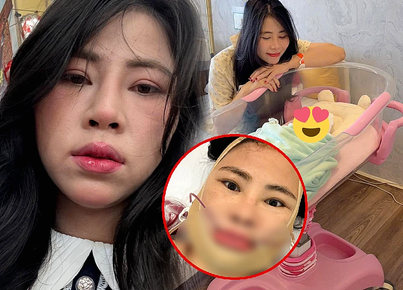 Nguyen Tho, whose newborn child was disfigured by cosmetic surgery, now regrets it, saying everything she did was for her child.