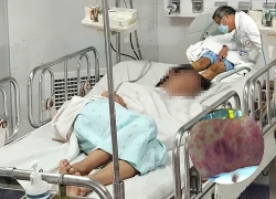 Ho Chi Minh City sees more cases of meningococcal meningitis, which is spreading rapidly and could have severe consequences?