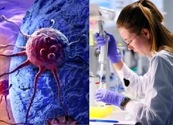 Nga tạo virus "không tồn tại trong tự nhiên" có thể tiêu diệt tế bào ung thư?