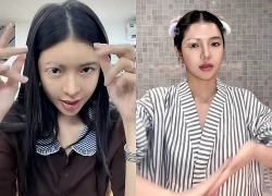 Mỹ nhân Việt mắc bệnh hiếm chỉ 2% dân số thế giới gặp phải