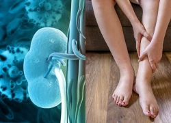 Dấu hiệu cảnh báo suy thận: Đi bộ thấy biểu hiện này cần đặc biệt lưu ý