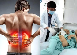 Suy thận mạn đang dần trẻ hóa, bác sĩ cảnh báo thói quen nhiều người mắc